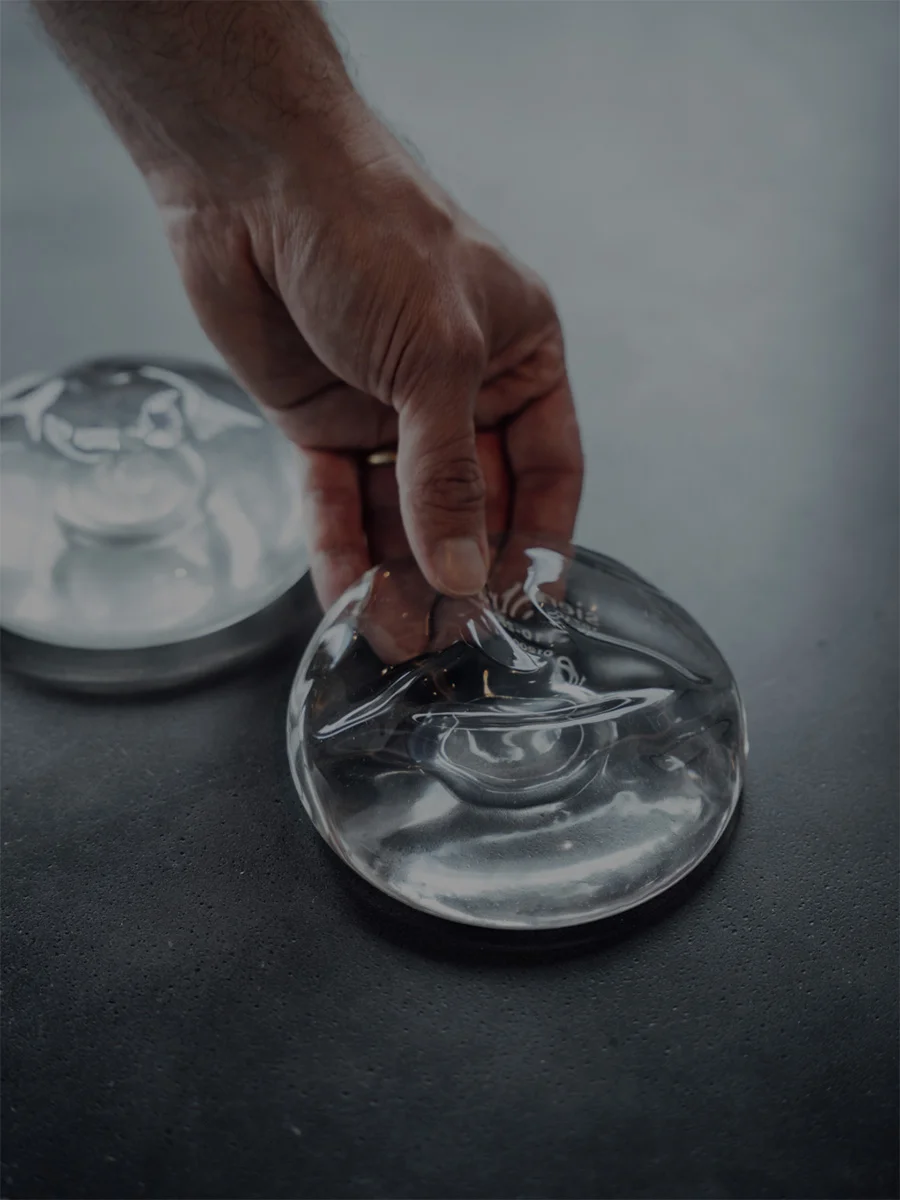 Hand placing clear contact lens in case with solution for proper storage and eye care - Breast in Chevy Chase, MD