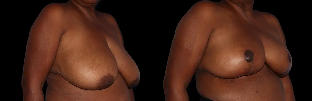 bj _11538_black_2
