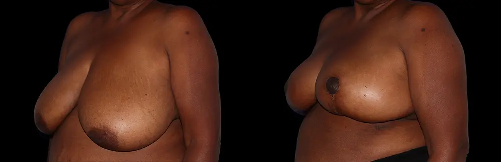 bj _11538_black_4