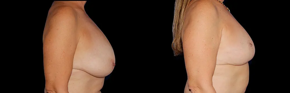 sk_26363_black-5